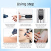 Lapiz Plasma Eliminacion De Manchas